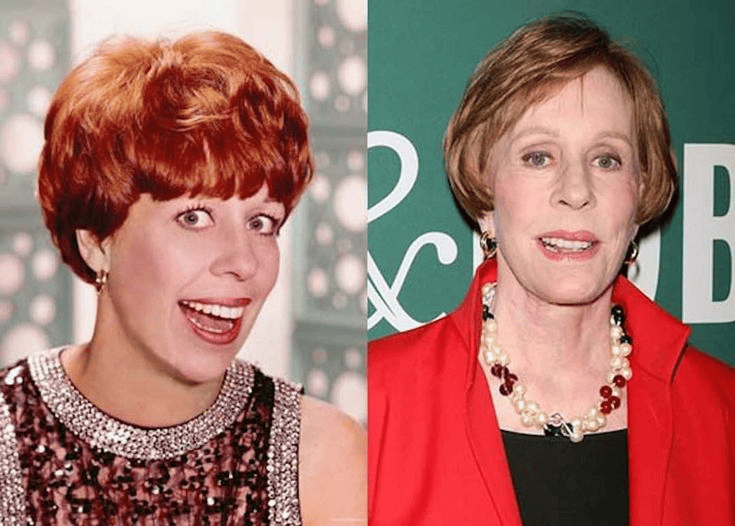 Carol Burnett Plastic Surgery