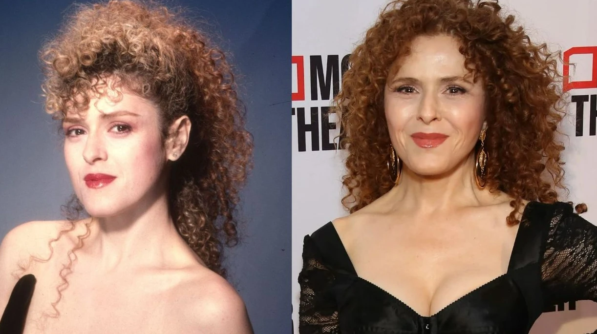 Bernadette Peters Plastic Surgery