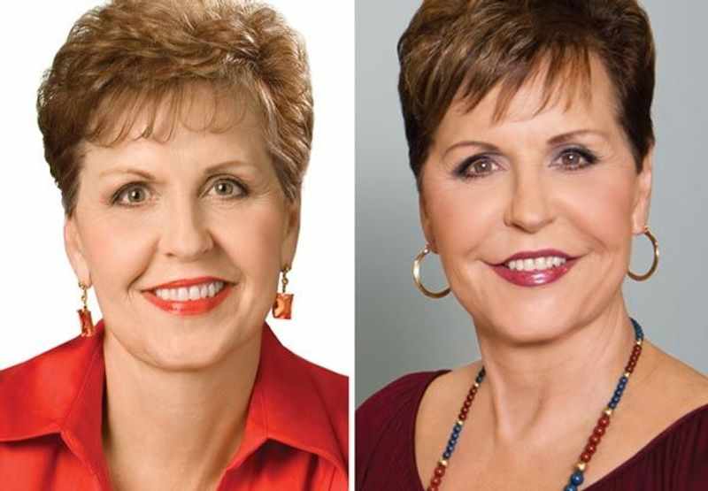 Joyce Meyer Plastic Surgery