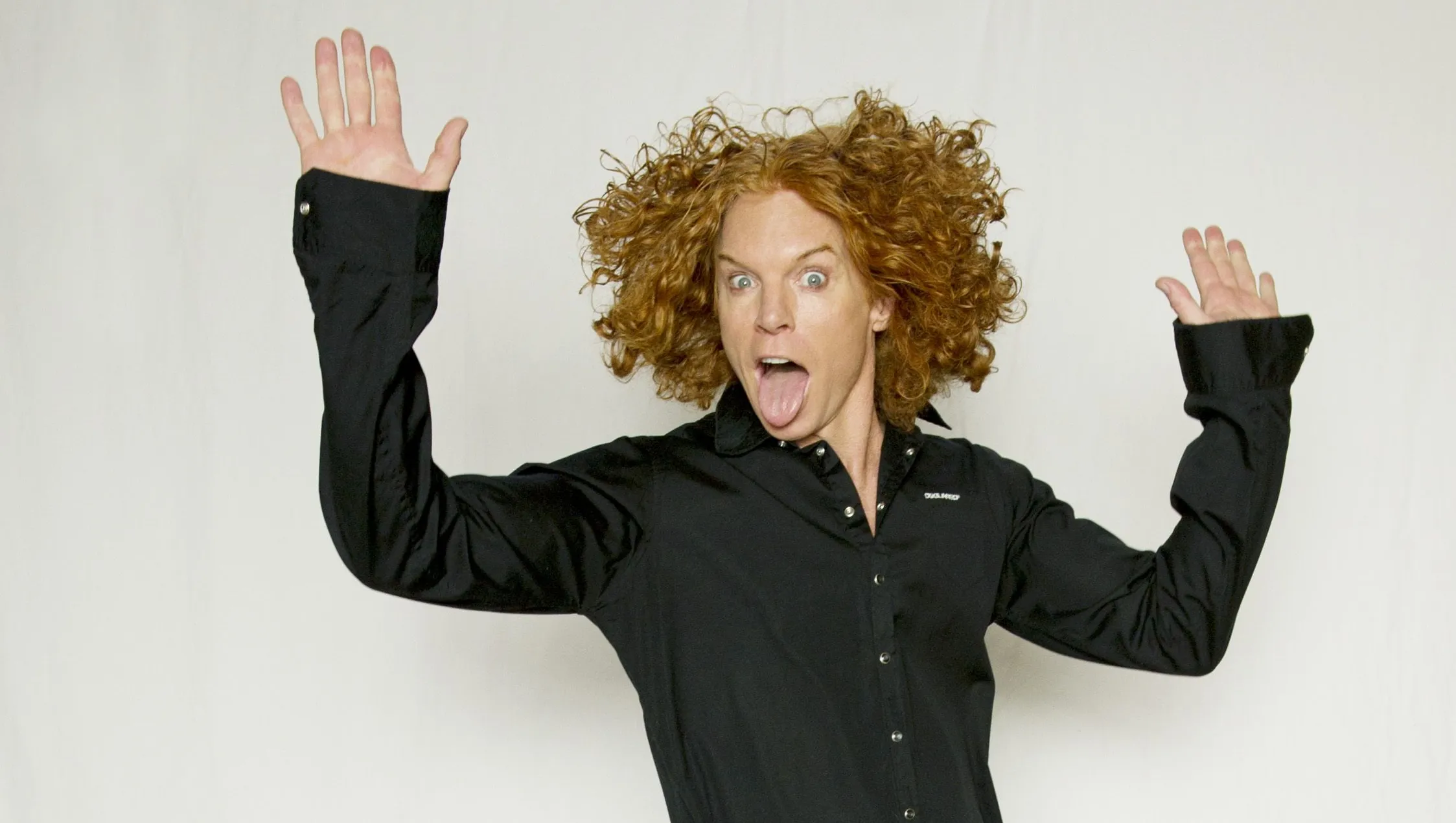 Carrot Top Plastic Surgery