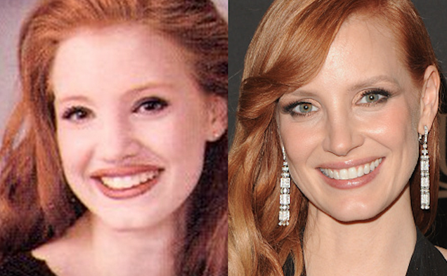 Jessica Chastain Plastic Surgery