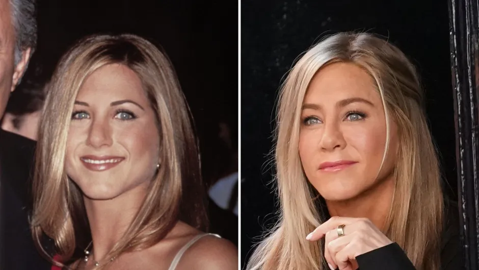 Jennifer Aniston Plastic Surgery