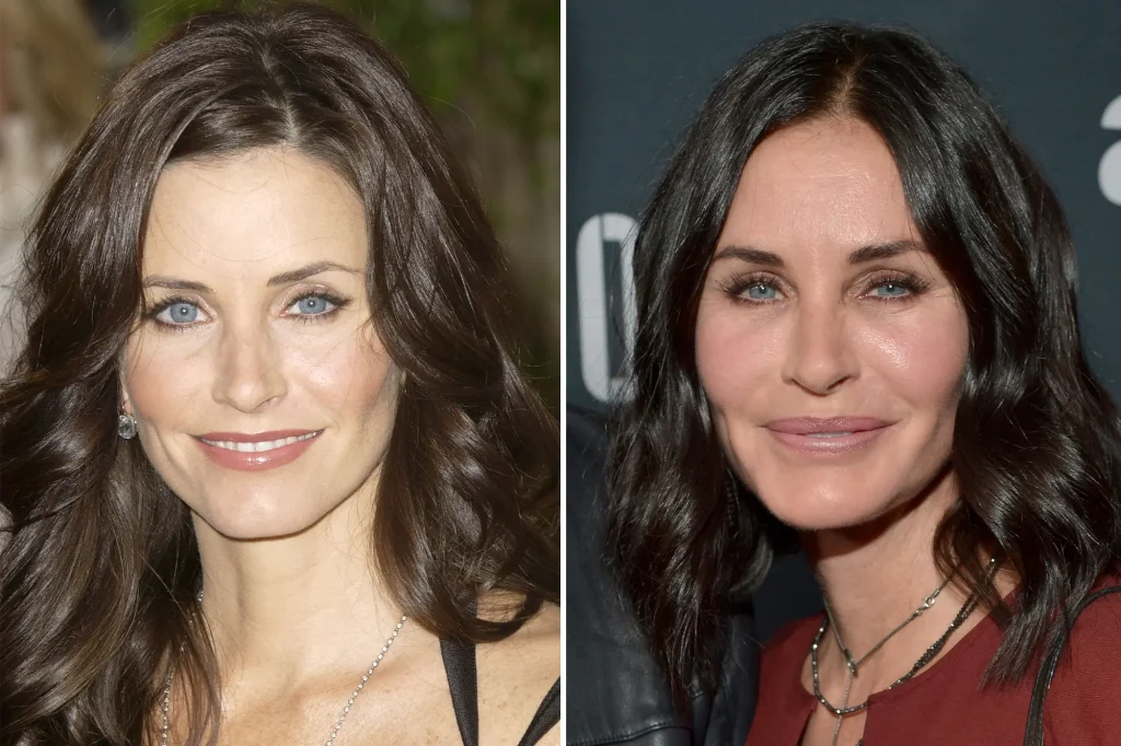 Courteney Cox Plastic Surgery