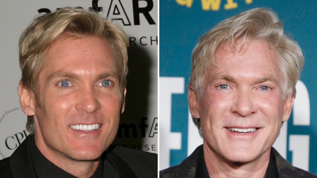 Sam Champion Plastic Surgery