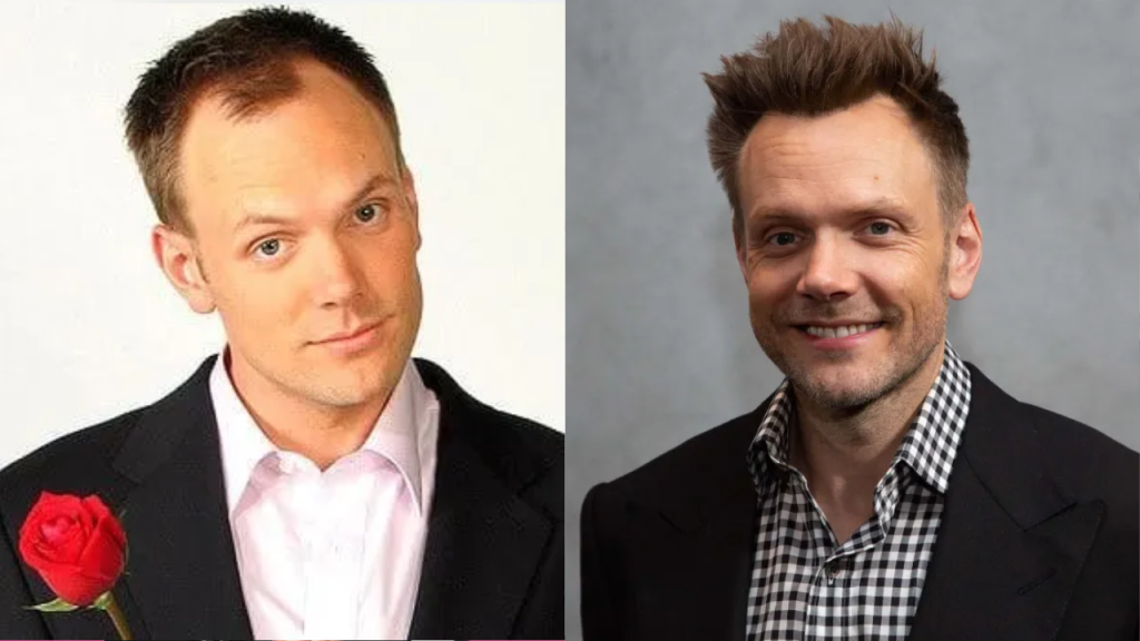 Joel McHale’s plastic surgery
