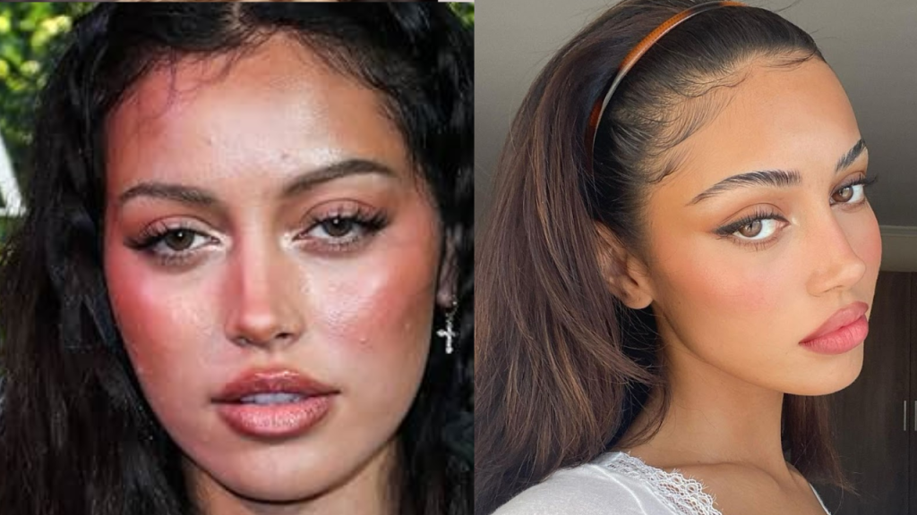 cindy kimberly plastic surgery
