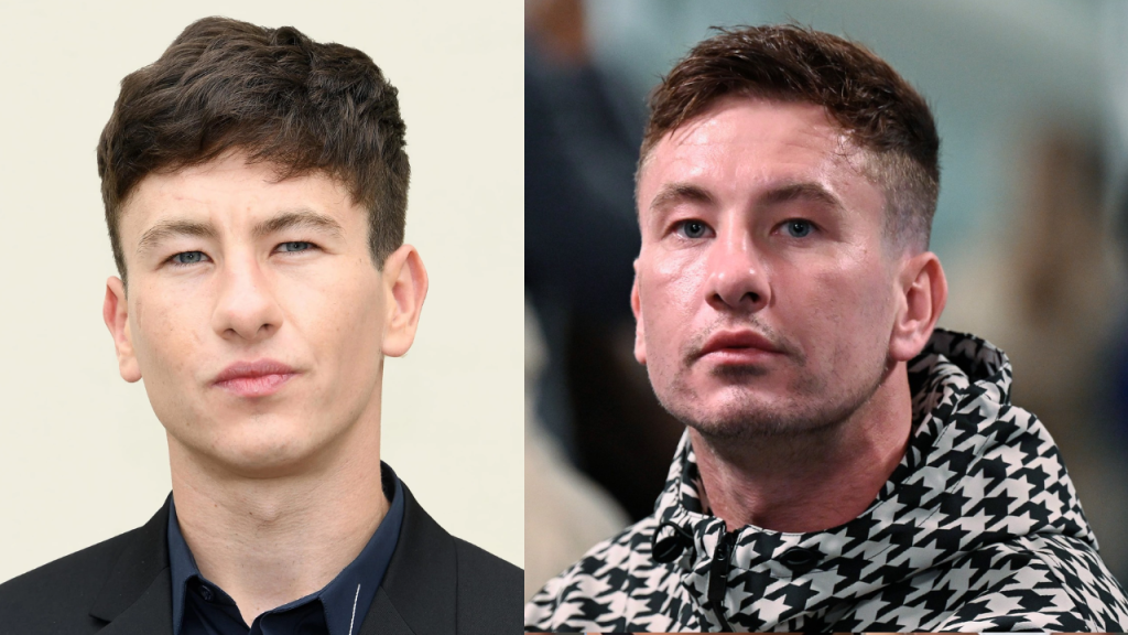 Barry Keoghan’s Plastic Surgery