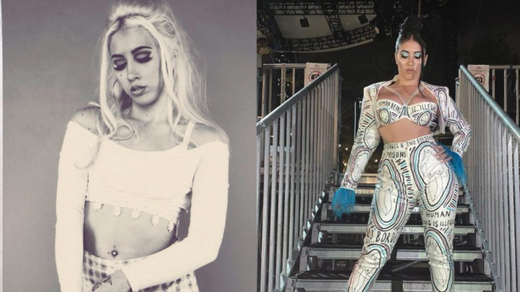 kali uchis plastic surgery