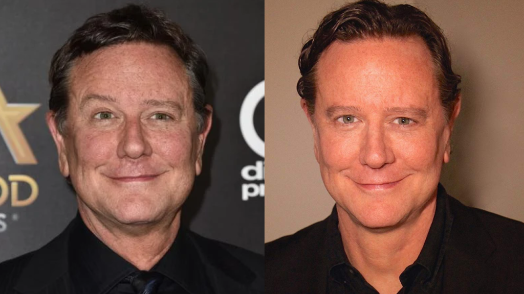 judge reinhold plastic surgery