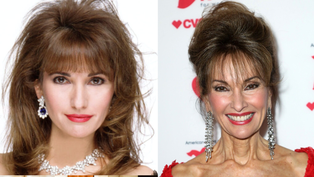 susan lucci plastic surgery