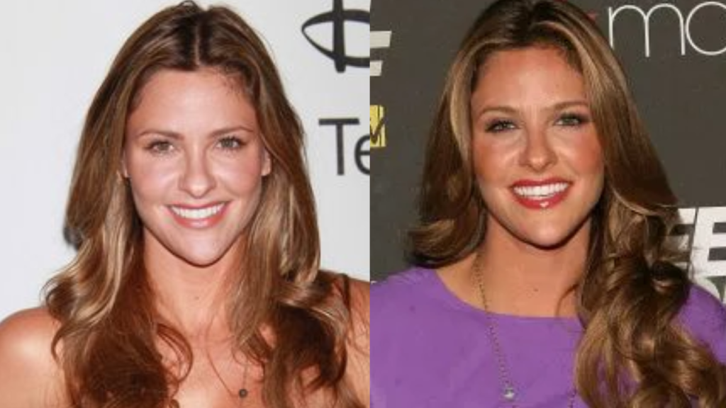 jill wagner plastic surgery