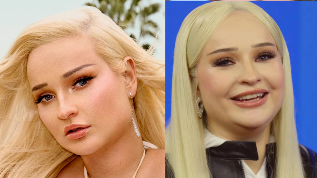 Kim Petras Plastic Surgery: