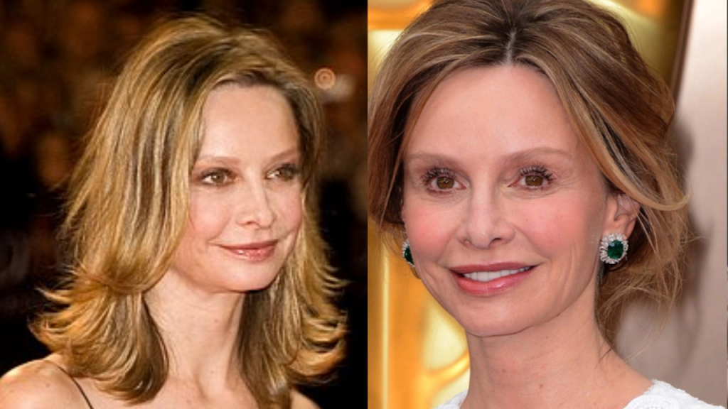 calista flockhart plastic surgery