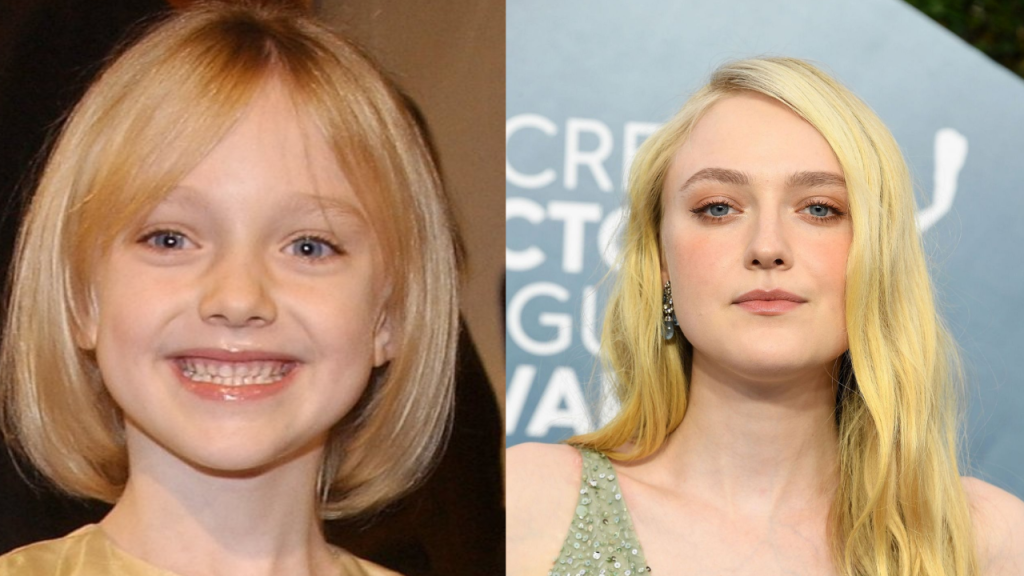 Dakota Fanning’s Plastic Surgery