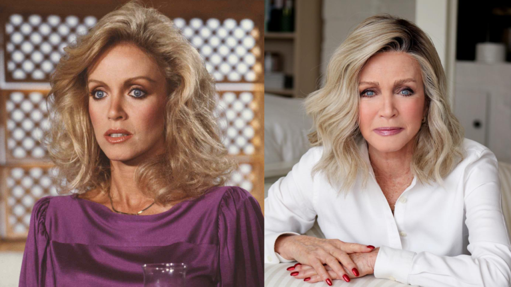 donna mills plastic surgery