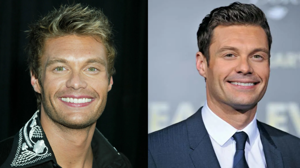 Ryan Seacrest Plastic Surgery