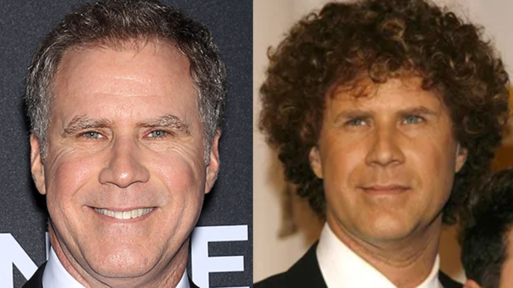 will ferrell plastic surgery