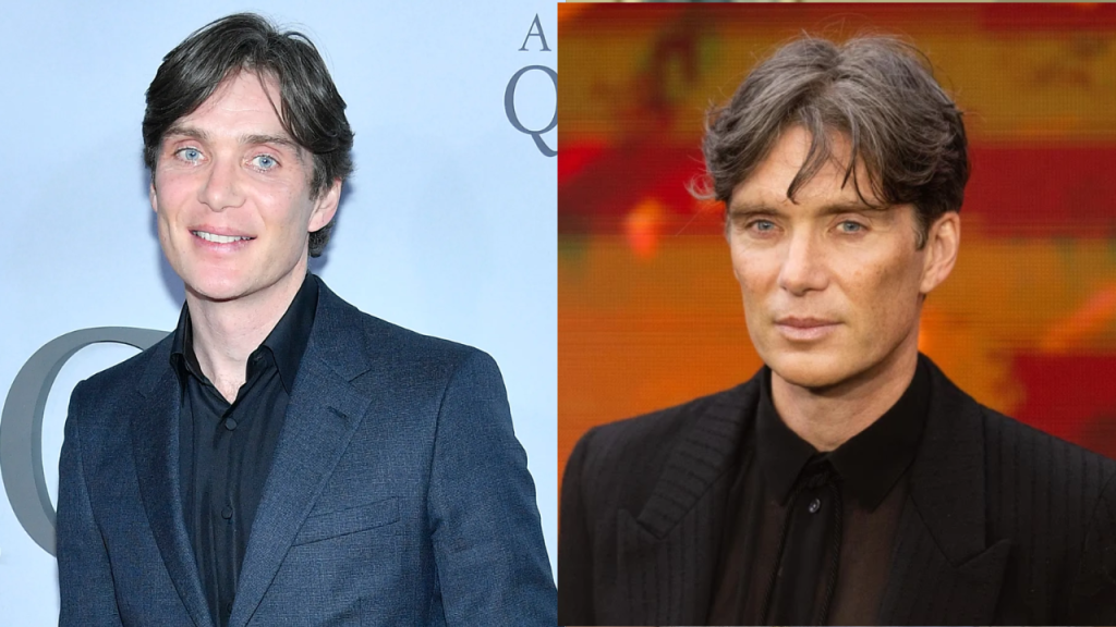 cillian murphy plastic surgery