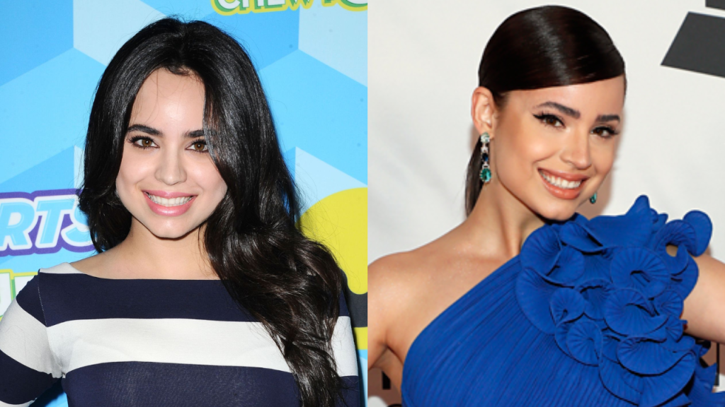 Sofia Carson plastic surgery