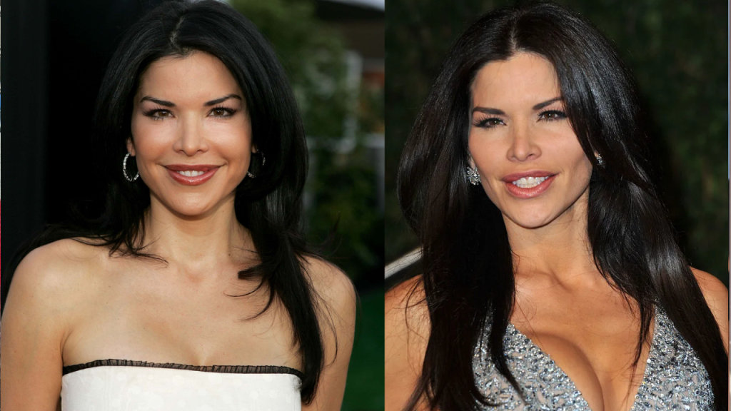 lauren sanchez plastic surgery