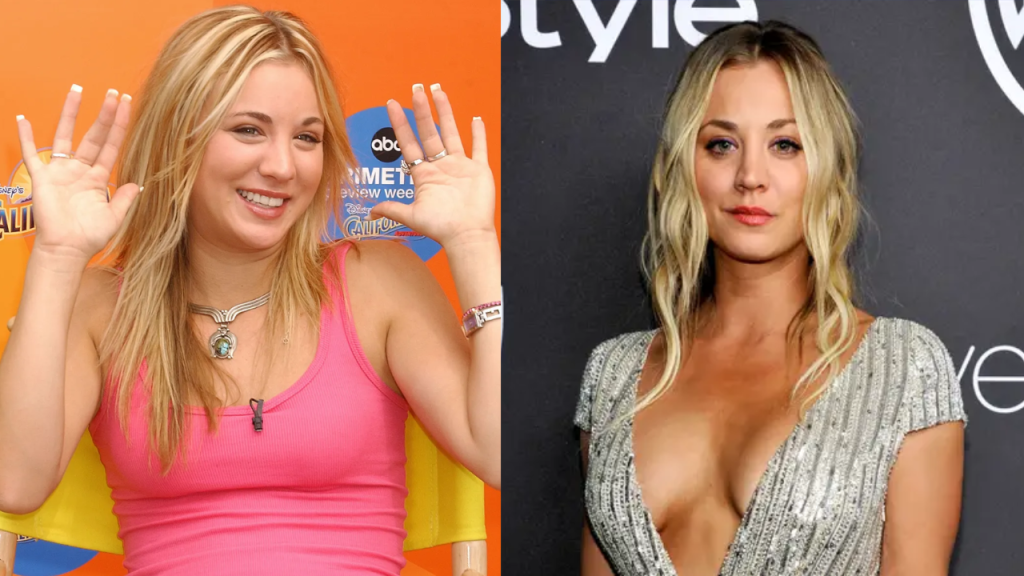 kaley cuoco plastic surgery