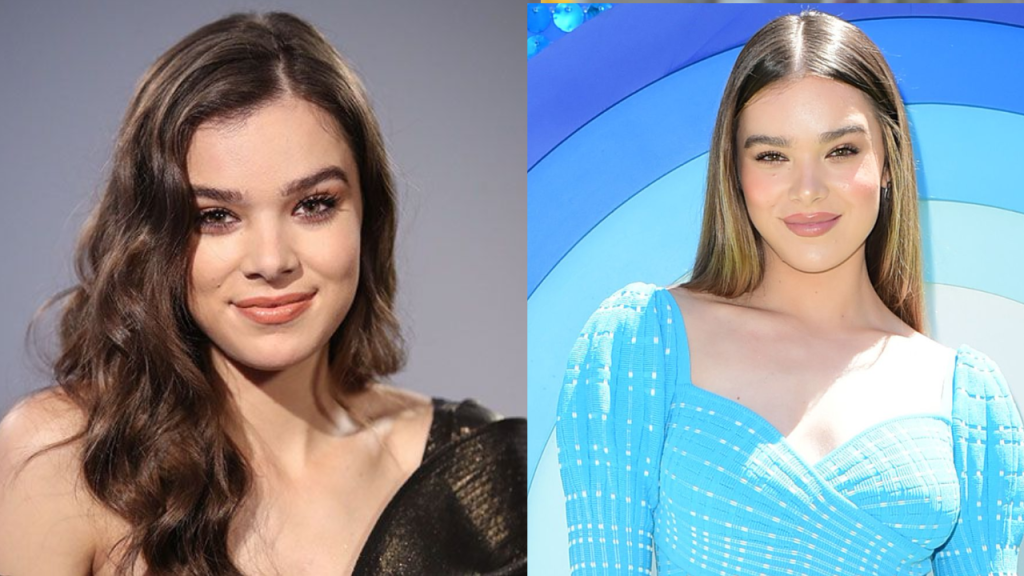 Hailee Steinfeld Plastic Surgery