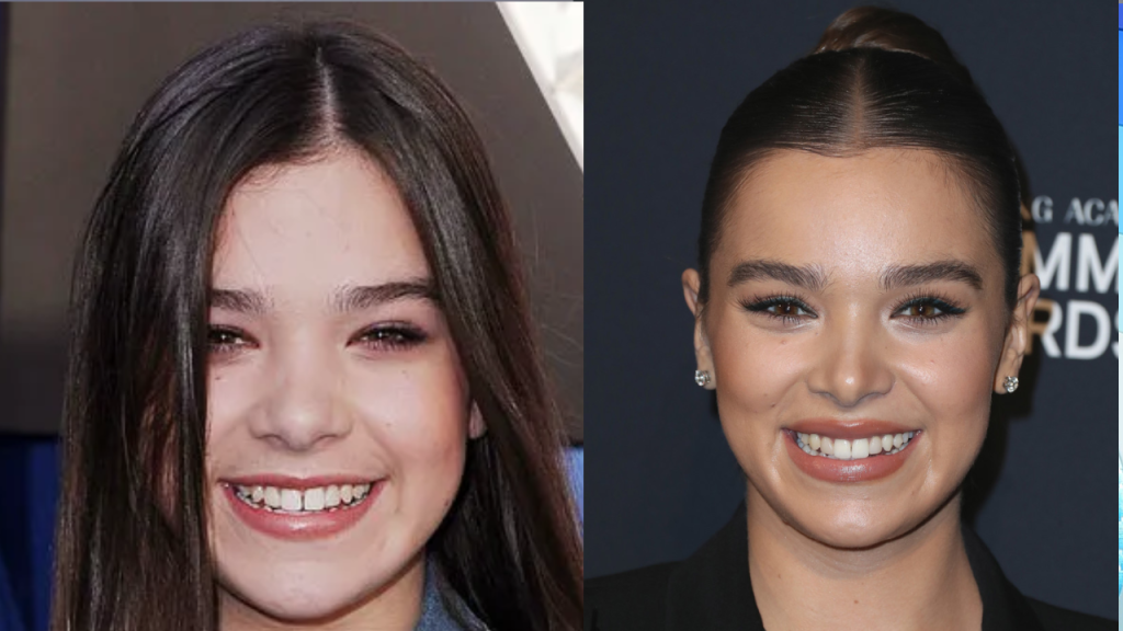  Hailee Steinfeld Plastic Surgery
