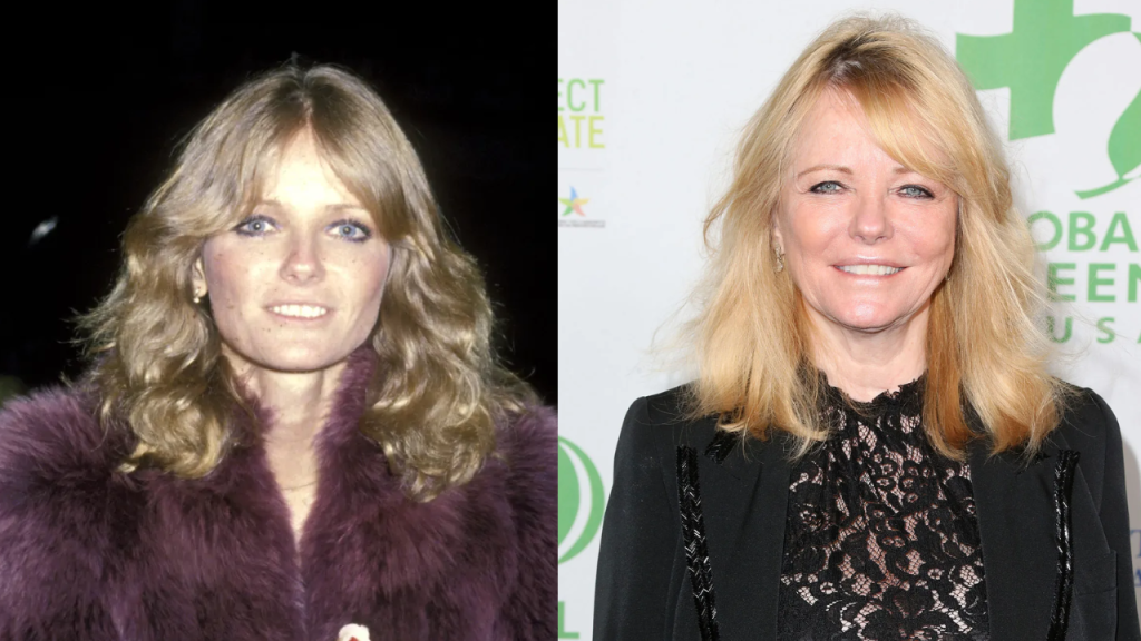 Cheryl Tiegs Plastic Surgery