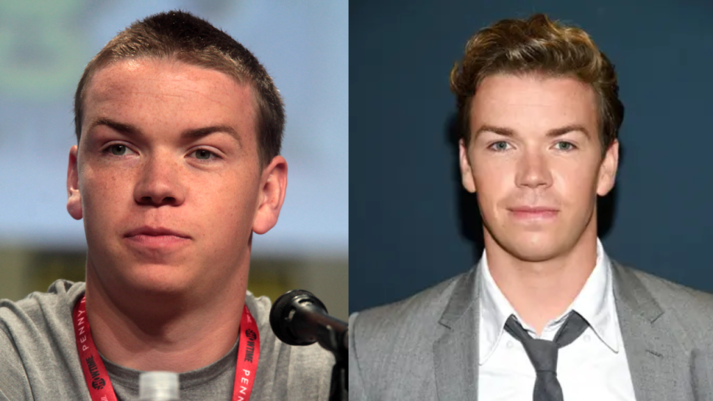 Will Poulter Plastic Surgery