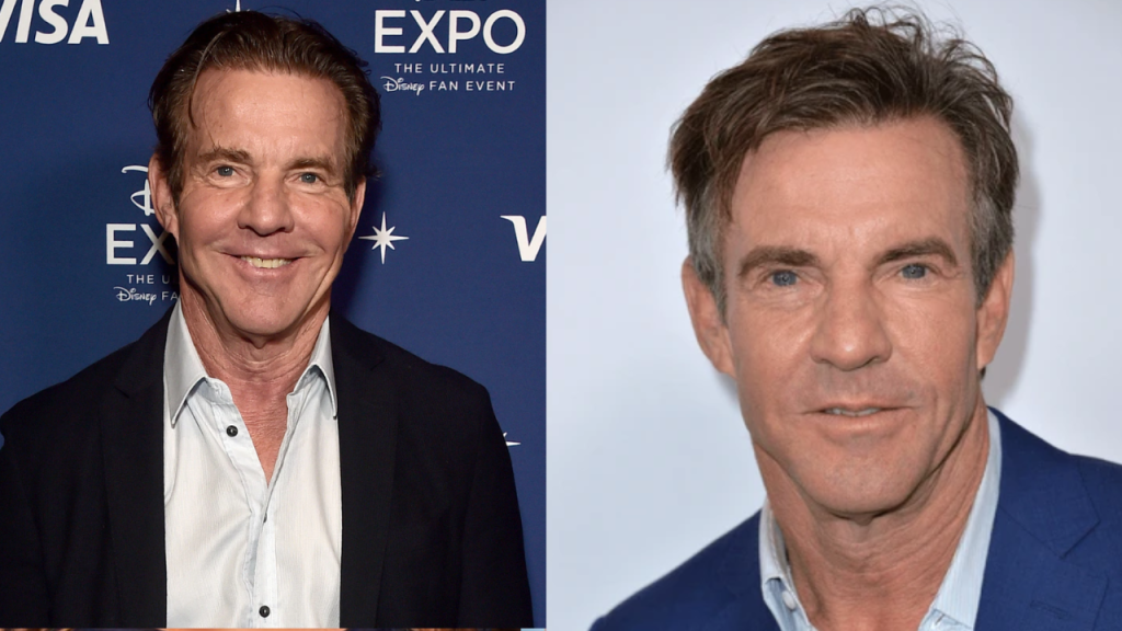  Dennis Quaid Plastic Surgery