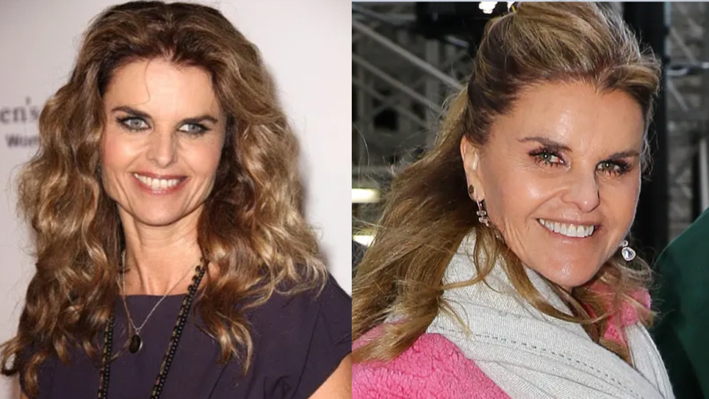 maria shriver plastic surgery