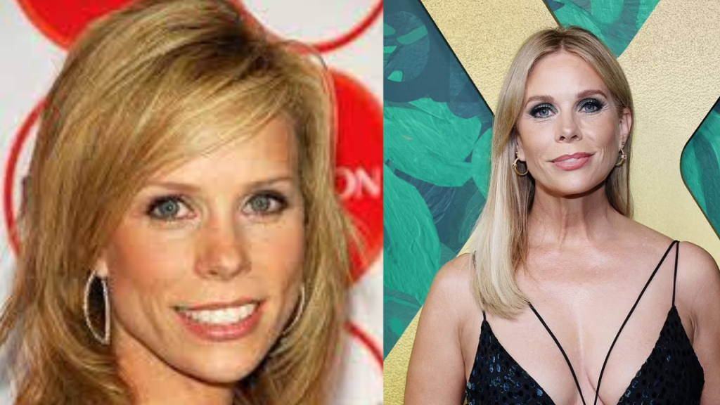 cheryl hines plastic surgery