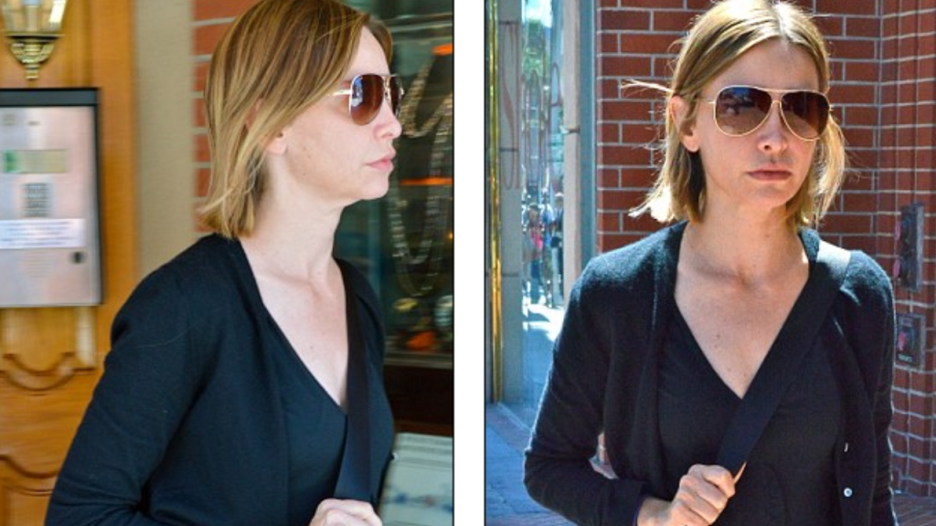 calista flockhart plastic surgery