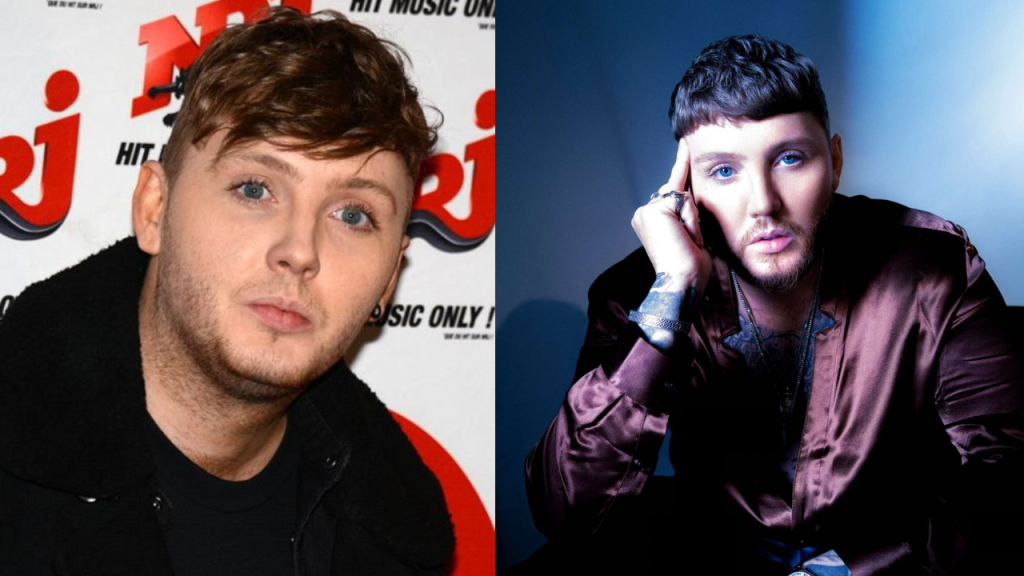 James Arthur Plastic Surgery