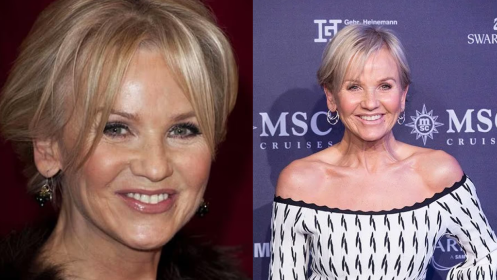 Lisa Maxwell Plastic Surgery