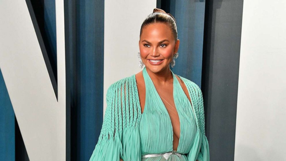 chrissy teigen plastic surgery
