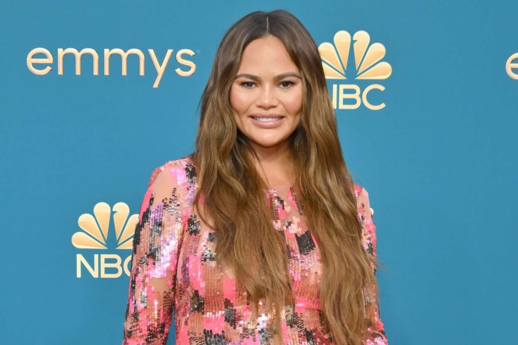 chrissy teigen plastic surgery
