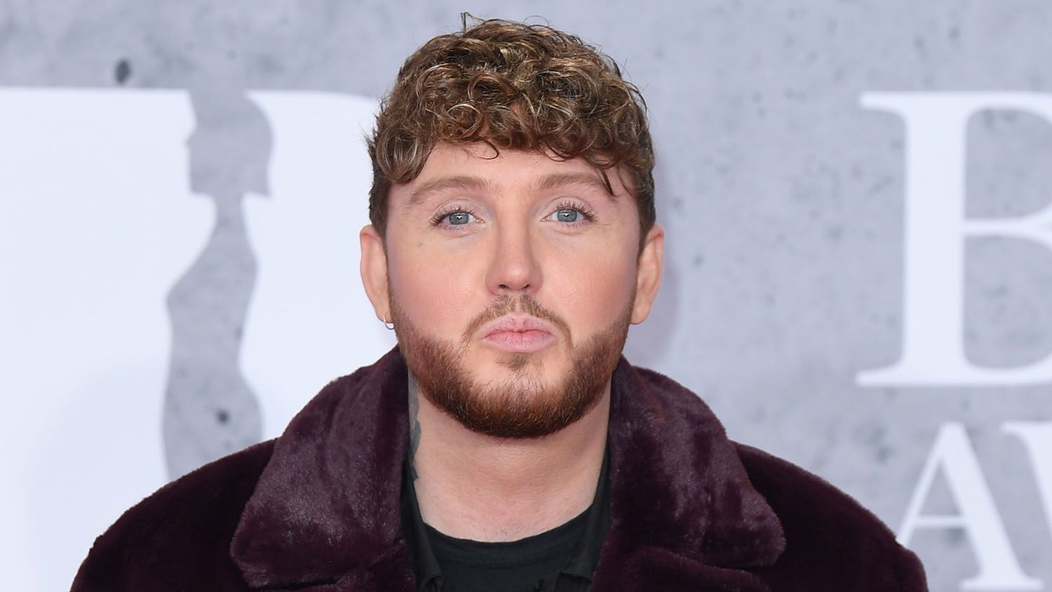 James Arthur Plastic Surgery