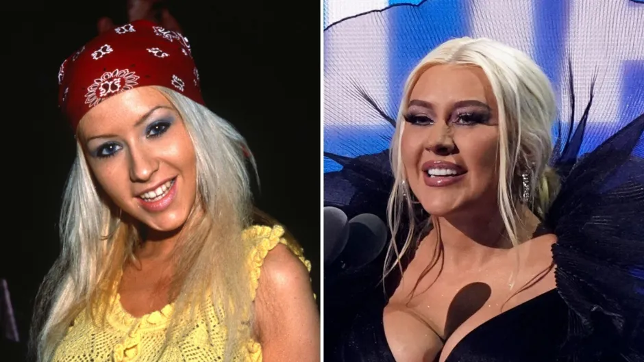 Christina Aguilera Plastic Surgery: She Open Up About Her Plastic Surgery