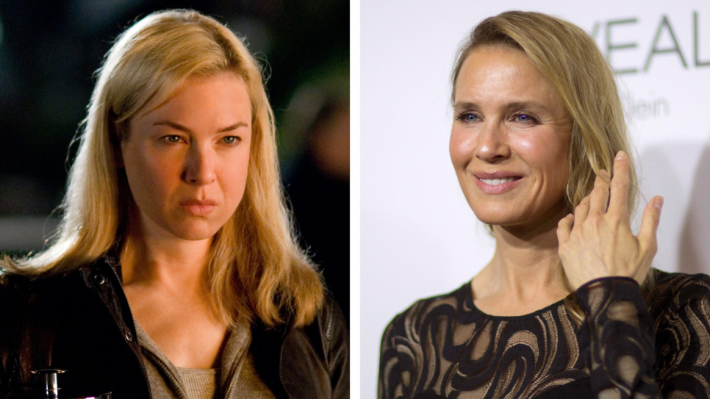 renee zellweger plastic surgery