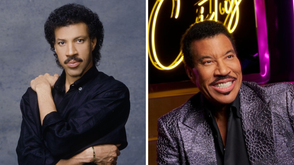 lionel richie plastic surgery