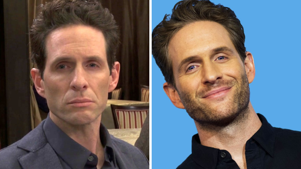 glenn howerton plastic surgery