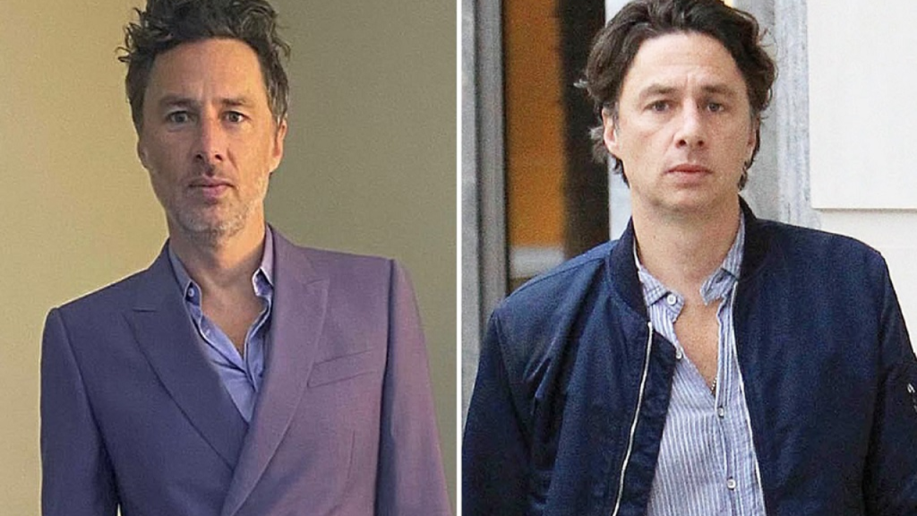 Zach Braff Plastic Surgery