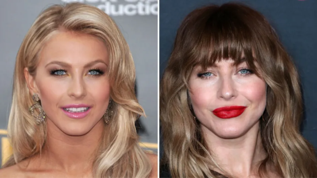 Julianne Hough Plastic Surgery