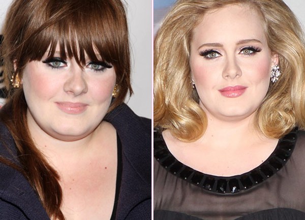 Adele Plastic Surgery: Has She Had Plastic Surgery?