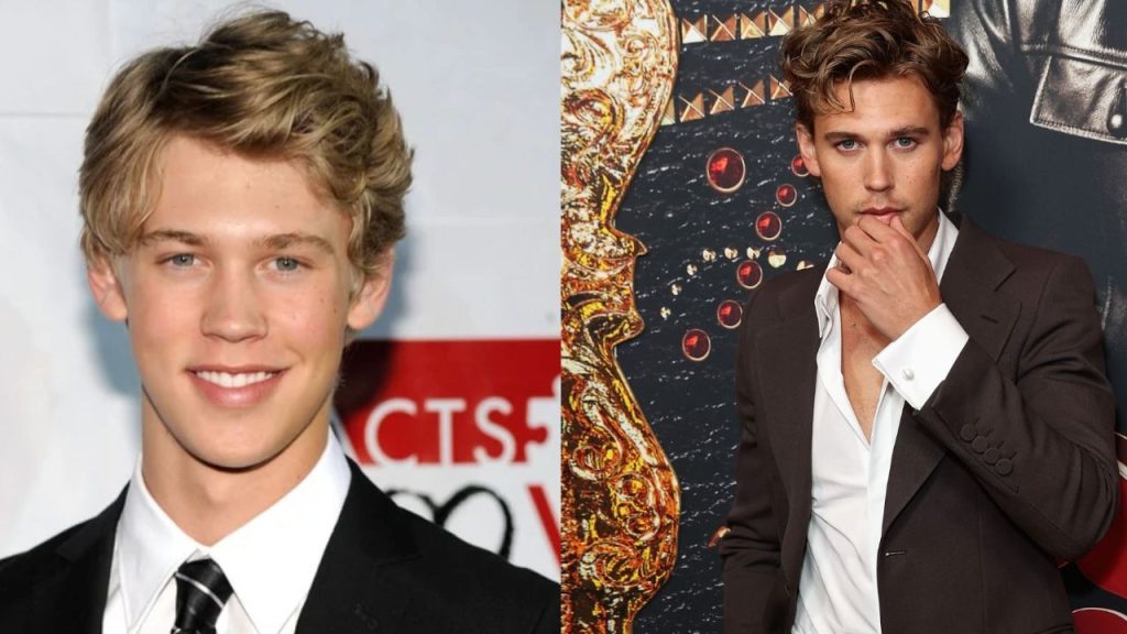 Did Austin Butler have surgery to change his looks?