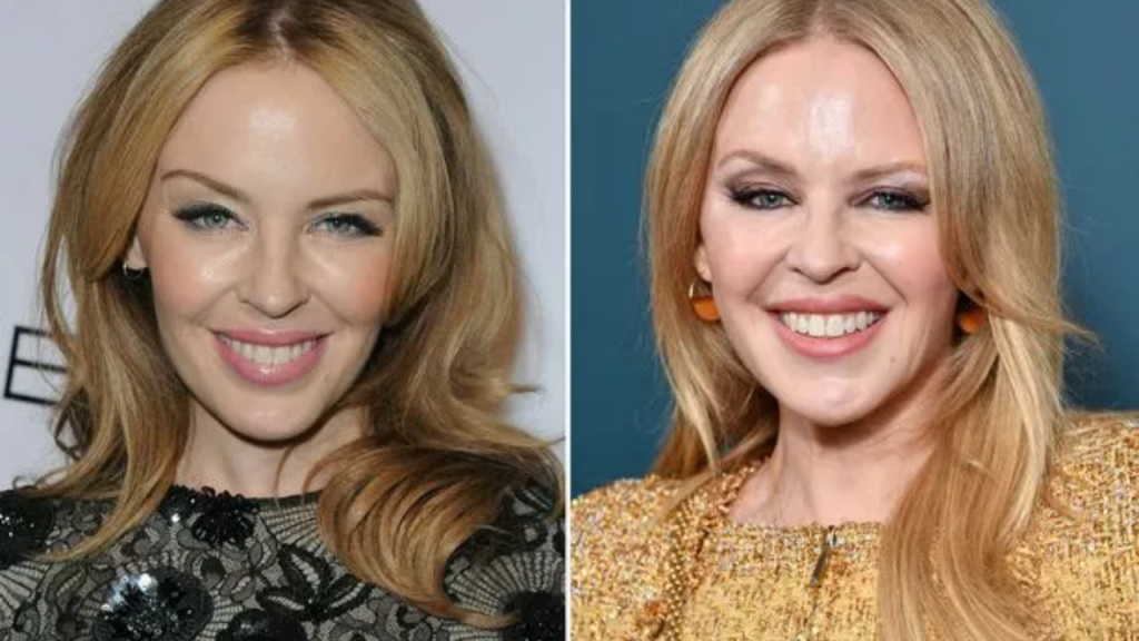 Kylie Minogue Plastic Surgery: Let's reveal the truth