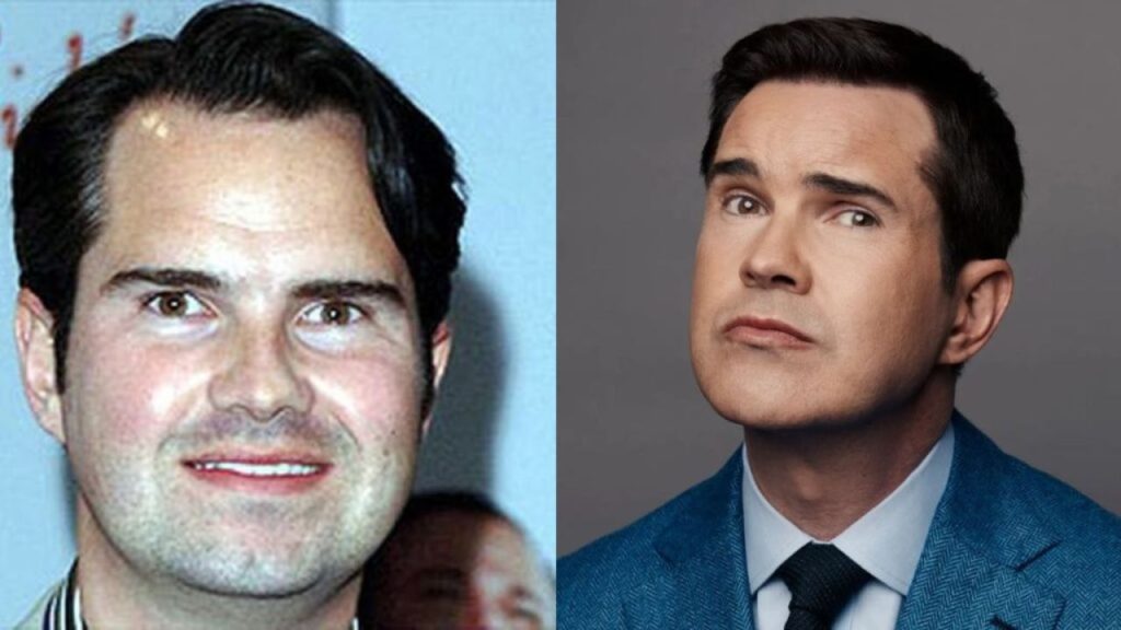 Jimmy Carr Gets a Face Change