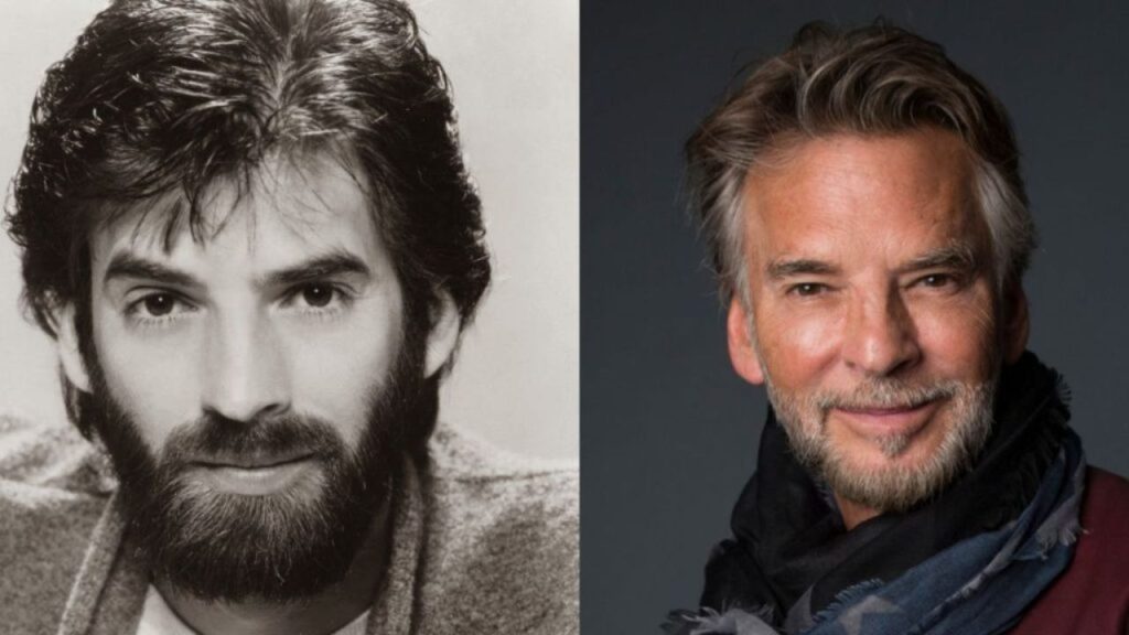 Kenny Loggins Plastic Surgery: Did He Have Plastic Surgery? 