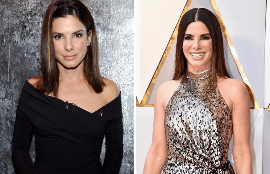 Sandra Bullock Plastic Surgery: The Truth About Plastic Surgery Gossip